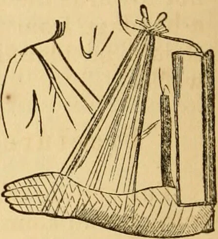An illustration from The household physician : for the use of families, planters, seamen, and travellers ; being a brief description, in plain language, of all the diseases of men, women, and children, with the newest and most approved methods of curing them / by Ira Warren., 1866, leaf 476