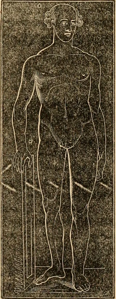 An illustration from The household physician : for the use of families, planters, seamen, and travellers ; being a brief description, in plain language, of all the diseases of men, women, and children, with the newest and most approved methods of curing them / by Ira Warren., 1866, leaf 479