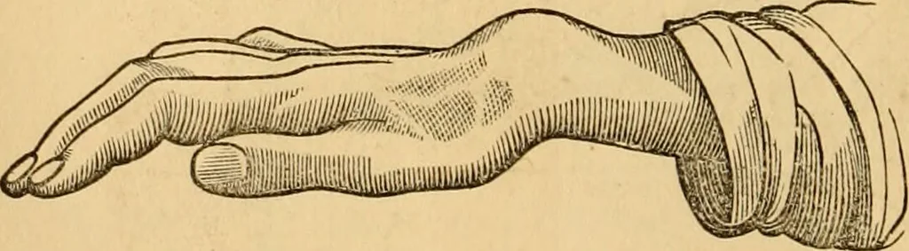 An illustration from The household physician : for the use of families, planters, seamen, and travellers ; being a brief description, in plain language, of all the diseases of men, women, and children, with the newest and most approved methods of curing them / by Ira Warren., 1866, leaf 486