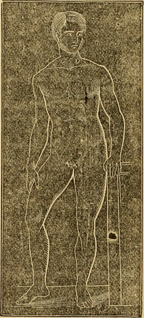An illustration from The household physician : for the use of families, planters, seamen, and travellers ; being a brief description, in plain language, of all the diseases of men, women, and children, with the newest and most approved methods of curing them / by Ira Warren., 1866, leaf 488