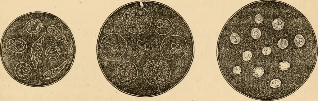 An illustration from The household physician : for the use of families, planters, seamen, and travellers ; being a brief description, in plain language, of all the diseases of men, women, and children, with the newest and most approved methods of curing them / by Ira Warren., 1866, leaf 495