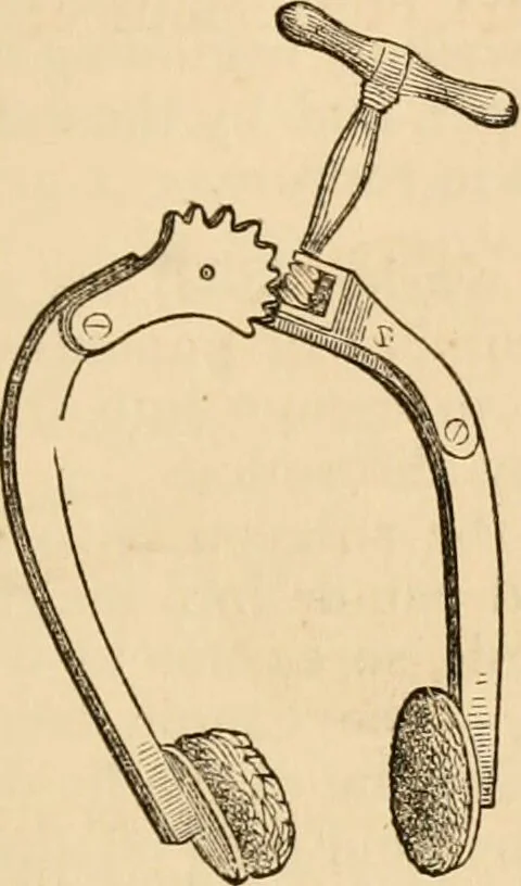An illustration from The household physician : for the use of families, planters, seamen, and travellers ; being a brief description, in plain language, of all the diseases of men, women, and children, with the newest and most approved methods of curing them / by Ira Warren., 1866, leaf 499
