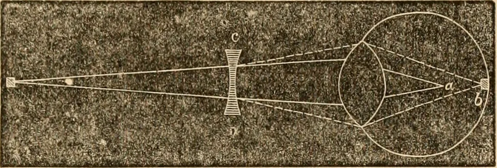 An illustration from The household physician : for the use of families, planters, seamen, and travellers ; being a brief description, in plain language, of all the diseases of men, women, and children, with the newest and most approved methods of curing them / by Ira Warren., 1866, leaf 513