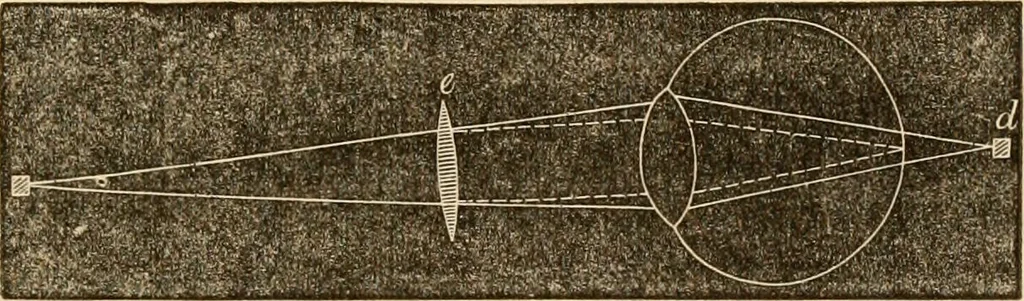 An illustration from The household physician : for the use of families, planters, seamen, and travellers ; being a brief description, in plain language, of all the diseases of men, women, and children, with the newest and most approved methods of curing them / by Ira Warren., 1866, leaf 513