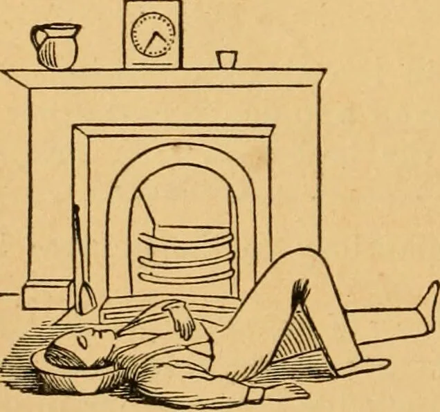 An illustration from The household physician : for the use of families, planters, seamen, and travellers ; being a brief description, in plain language, of all the diseases of men, women, and children, with the newest and most approved methods of curing them / by Ira Warren., 1866, leaf 562