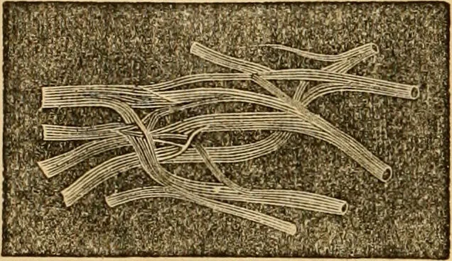 An illustration from The household physician : for the use of families, planters, seamen, and travellers ; being a brief description, in plain language, of all the diseases of men, women, and children, with the newest and most approved methods of curing them / by Ira Warren., 1866, leaf 58