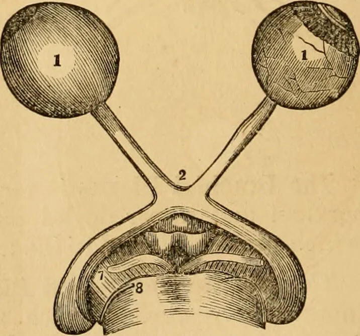 An illustration from The household physician : for the use of families, planters, seamen, and travellers ; being a brief description, in plain language, of all the diseases of men, women, and children, with the newest and most approved methods of curing them / by Ira Warren., 1866, leaf 58