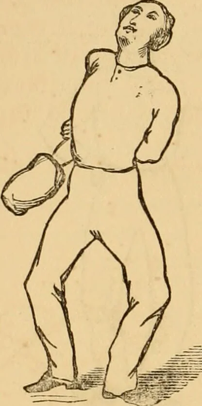 An illustration from The household physician : for the use of families, planters, seamen, and travellers ; being a brief description, in plain language, of all the diseases of men, women, and children, with the newest and most approved methods of curing them / by Ira Warren., 1866, leaf 762
