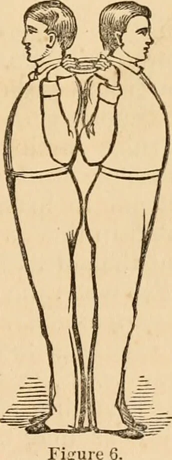 An illustration from The household physician : for the use of families, planters, seamen, and travellers ; being a brief description, in plain language, of all the diseases of men, women, and children, with the newest and most approved methods of curing them / by Ira Warren., 1866, leaf 767