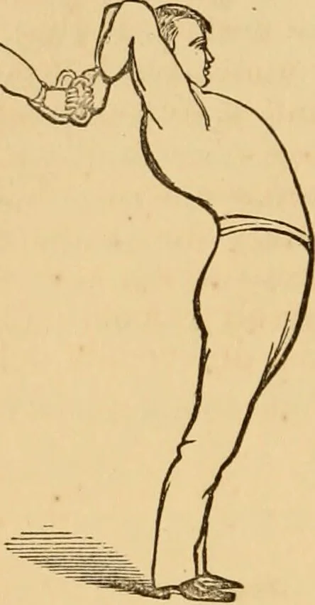 An illustration from The household physician : for the use of families, planters, seamen, and travellers ; being a brief description, in plain language, of all the diseases of men, women, and children, with the newest and most approved methods of curing them / by Ira Warren., 1866, leaf 774