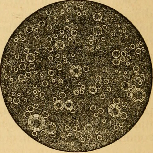 An illustration from The household physician : for the use of families, planters, seamen, and travellers ; being a brief description, in plain language, of all the diseases of men, women, and children, with the newest and most approved methods of curing them / by Ira Warren., 1866, leaf 84