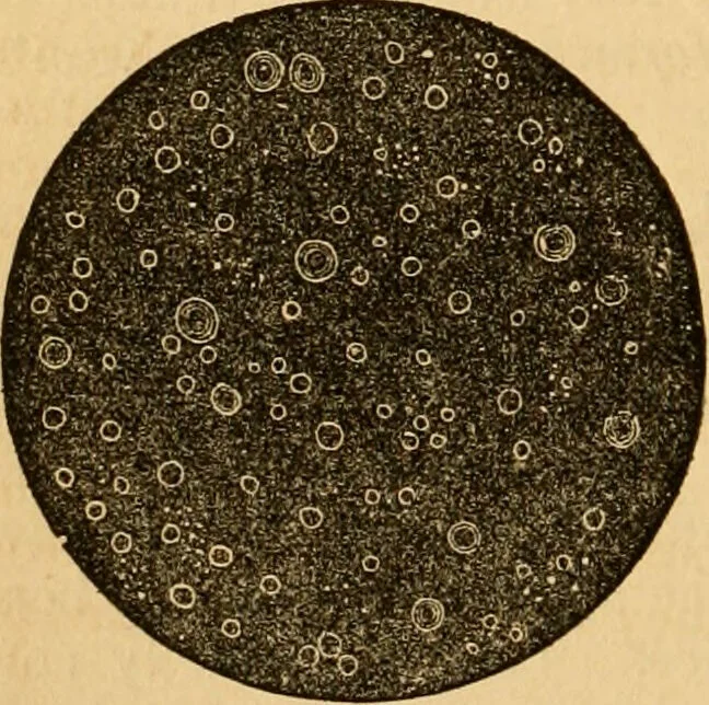 An illustration from The household physician : for the use of families, planters, seamen, and travellers ; being a brief description, in plain language, of all the diseases of men, women, and children, with the newest and most approved methods of curing them / by Ira Warren., 1866, leaf 84