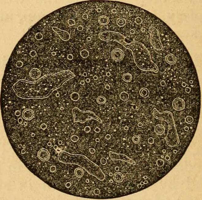 An illustration from The household physician : for the use of families, planters, seamen, and travellers ; being a brief description, in plain language, of all the diseases of men, women, and children, with the newest and most approved methods of curing them / by Ira Warren., 1866, leaf 84