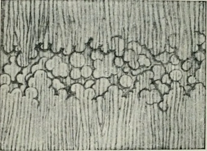 An illustration from Atlas and text-book of dentistry including diseases of the mouth / by Gustav Preiswerk. Edited by George W. Warren., 1906, leaf 104