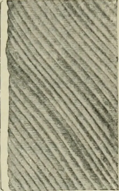 An illustration from Atlas and text-book of dentistry including diseases of the mouth / by Gustav Preiswerk. Edited by George W. Warren., 1906, leaf 107