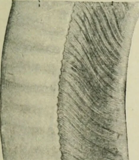 An illustration from Atlas and text-book of dentistry including diseases of the mouth / by Gustav Preiswerk. Edited by George W. Warren., 1906, leaf 107