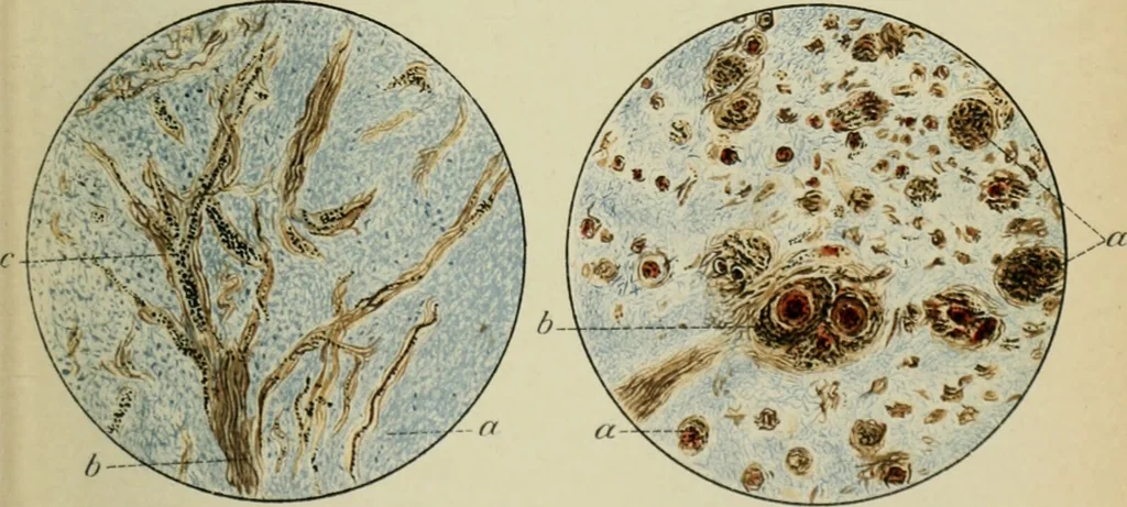 An illustration from Atlas and text-book of dentistry including diseases of the mouth / by Gustav Preiswerk. Edited by George W. Warren., 1906, leaf 111