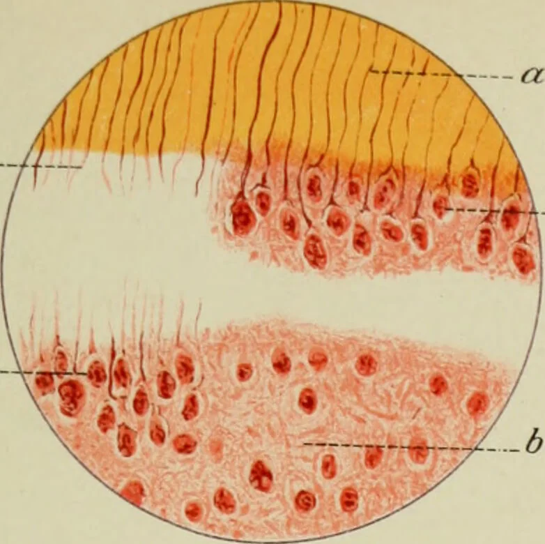 An illustration from Atlas and text-book of dentistry including diseases of the mouth / by Gustav Preiswerk. Edited by George W. Warren., 1906, leaf 115