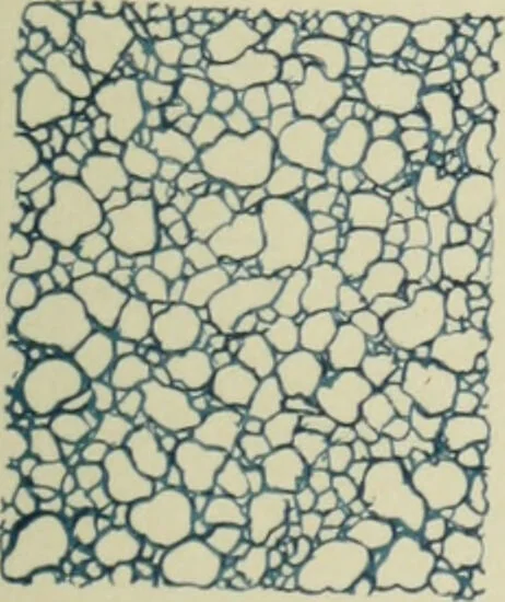 An illustration from Atlas and text-book of dentistry including diseases of the mouth / by Gustav Preiswerk. Edited by George W. Warren., 1906, leaf 115