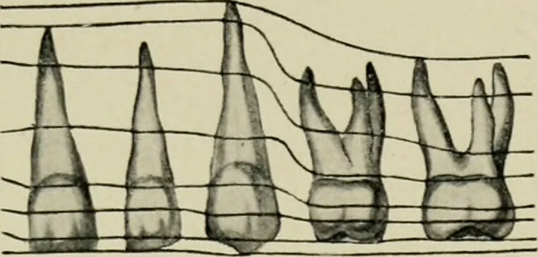 An illustration from Atlas and text-book of dentistry including diseases of the mouth / by Gustav Preiswerk. Edited by George W. Warren., 1906, leaf 145