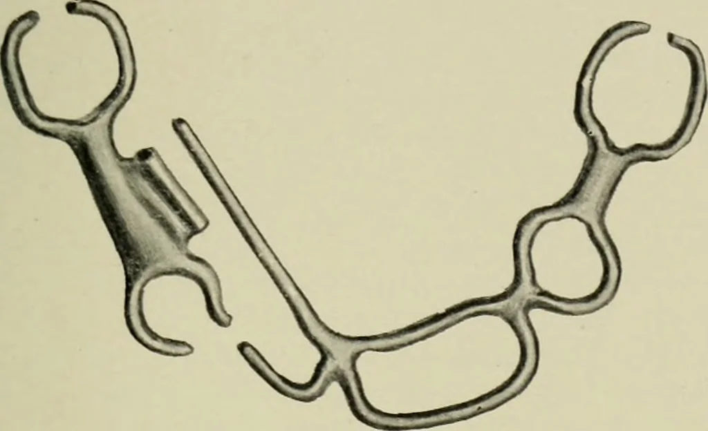 An illustration from Atlas and text-book of dentistry including diseases of the mouth / by Gustav Preiswerk. Edited by George W. Warren., 1906, leaf 207