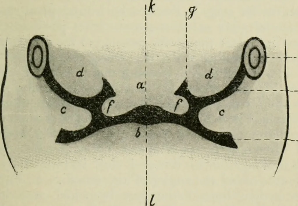 An illustration from Atlas and text-book of dentistry including diseases of the mouth / by Gustav Preiswerk. Edited by George W. Warren., 1906, leaf 227