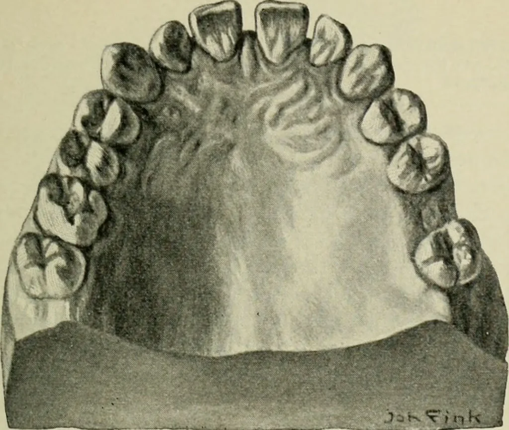 An illustration from Atlas and text-book of dentistry including diseases of the mouth / by Gustav Preiswerk. Edited by George W. Warren., 1906, leaf 247