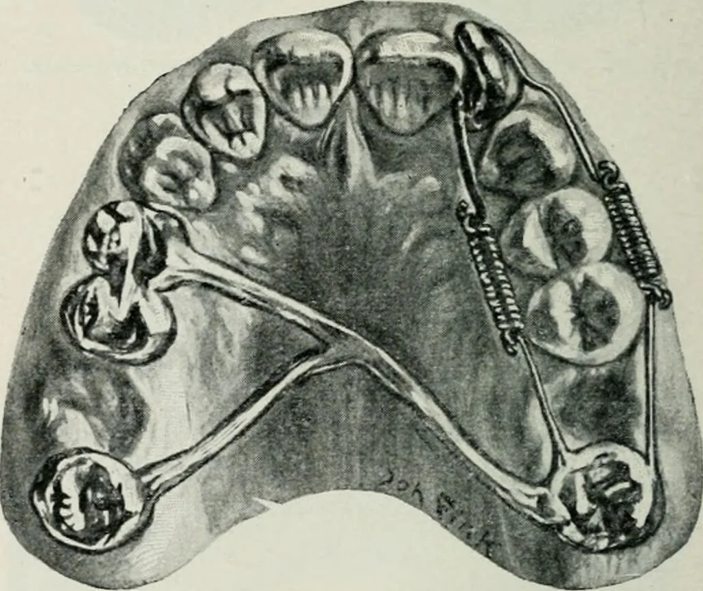 An illustration from Atlas and text-book of dentistry including diseases of the mouth / by Gustav Preiswerk. Edited by George W. Warren., 1906, leaf 254