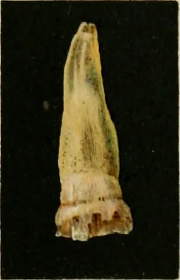 An illustration from Atlas and text-book of dentistry including diseases of the mouth / by Gustav Preiswerk. Edited by George W. Warren., 1906, leaf 263