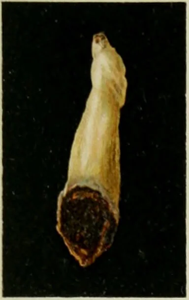 An illustration from Atlas and text-book of dentistry including diseases of the mouth / by Gustav Preiswerk. Edited by George W. Warren., 1906, leaf 267