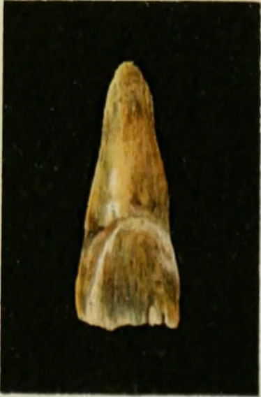 An illustration from Atlas and text-book of dentistry including diseases of the mouth / by Gustav Preiswerk. Edited by George W. Warren., 1906, leaf 267