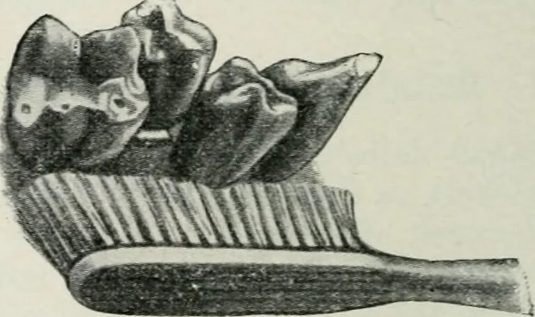 An illustration from Atlas and text-book of dentistry including diseases of the mouth / by Gustav Preiswerk. Edited by George W. Warren., 1906, leaf 270
