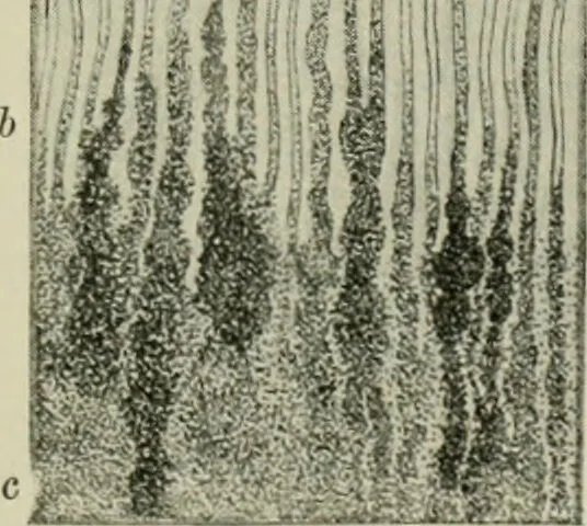 An illustration from Atlas and text-book of dentistry including diseases of the mouth / by Gustav Preiswerk. Edited by George W. Warren., 1906, leaf 285