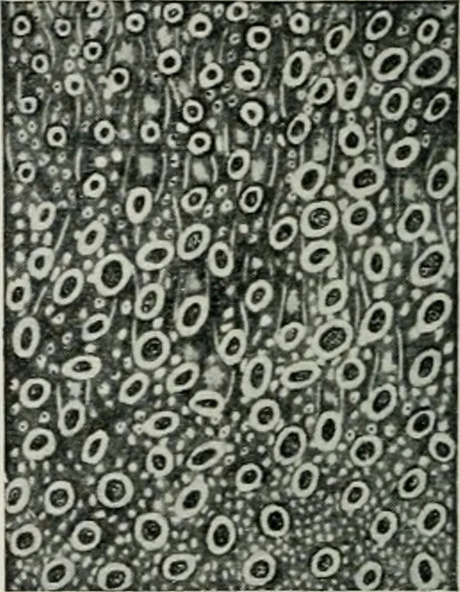 An illustration from Atlas and text-book of dentistry including diseases of the mouth / by Gustav Preiswerk. Edited by George W. Warren., 1906, leaf 286