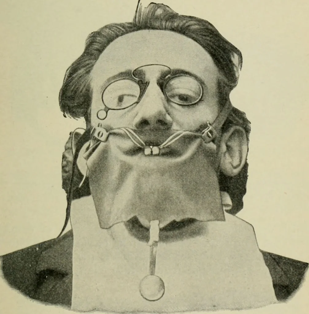 An illustration from Atlas and text-book of dentistry including diseases of the mouth / by Gustav Preiswerk. Edited by George W. Warren., 1906, leaf 309