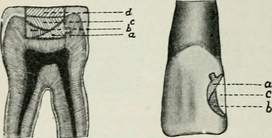 An illustration from Atlas and text-book of dentistry including diseases of the mouth / by Gustav Preiswerk. Edited by George W. Warren., 1906, leaf 326
