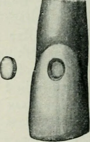 An illustration from Atlas and text-book of dentistry including diseases of the mouth / by Gustav Preiswerk. Edited by George W. Warren., 1906, leaf 334