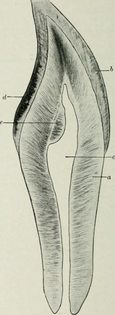 An illustration from Atlas and text-book of dentistry including diseases of the mouth / by Gustav Preiswerk. Edited by George W. Warren., 1906, leaf 338