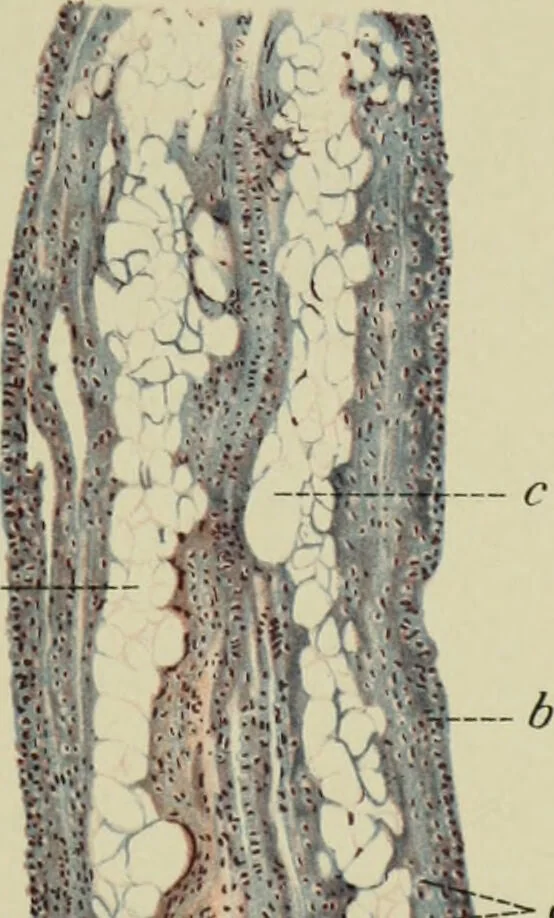 An illustration from Atlas and text-book of dentistry including diseases of the mouth / by Gustav Preiswerk. Edited by George W. Warren., 1906, leaf 363