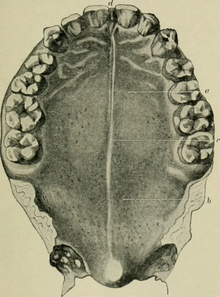 An illustration from Atlas and text-book of dentistry including diseases of the mouth / by Gustav Preiswerk. Edited by George W. Warren., 1906, leaf 41