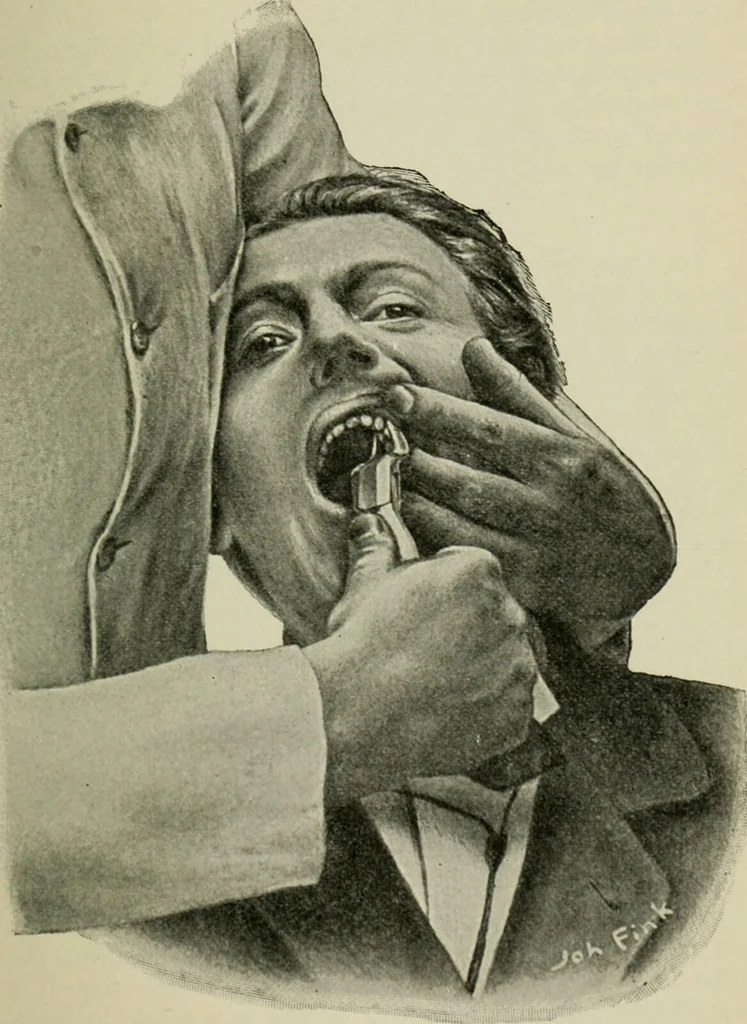 An illustration from Atlas and text-book of dentistry including diseases of the mouth / by Gustav Preiswerk. Edited by George W. Warren., 1906, leaf 413