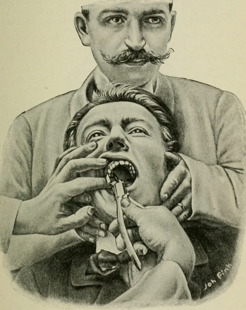 An illustration from Atlas and text-book of dentistry including diseases of the mouth / by Gustav Preiswerk. Edited by George W. Warren., 1906, leaf 415