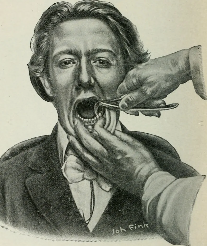 An illustration from Atlas and text-book of dentistry including diseases of the mouth / by Gustav Preiswerk. Edited by George W. Warren., 1906, leaf 416