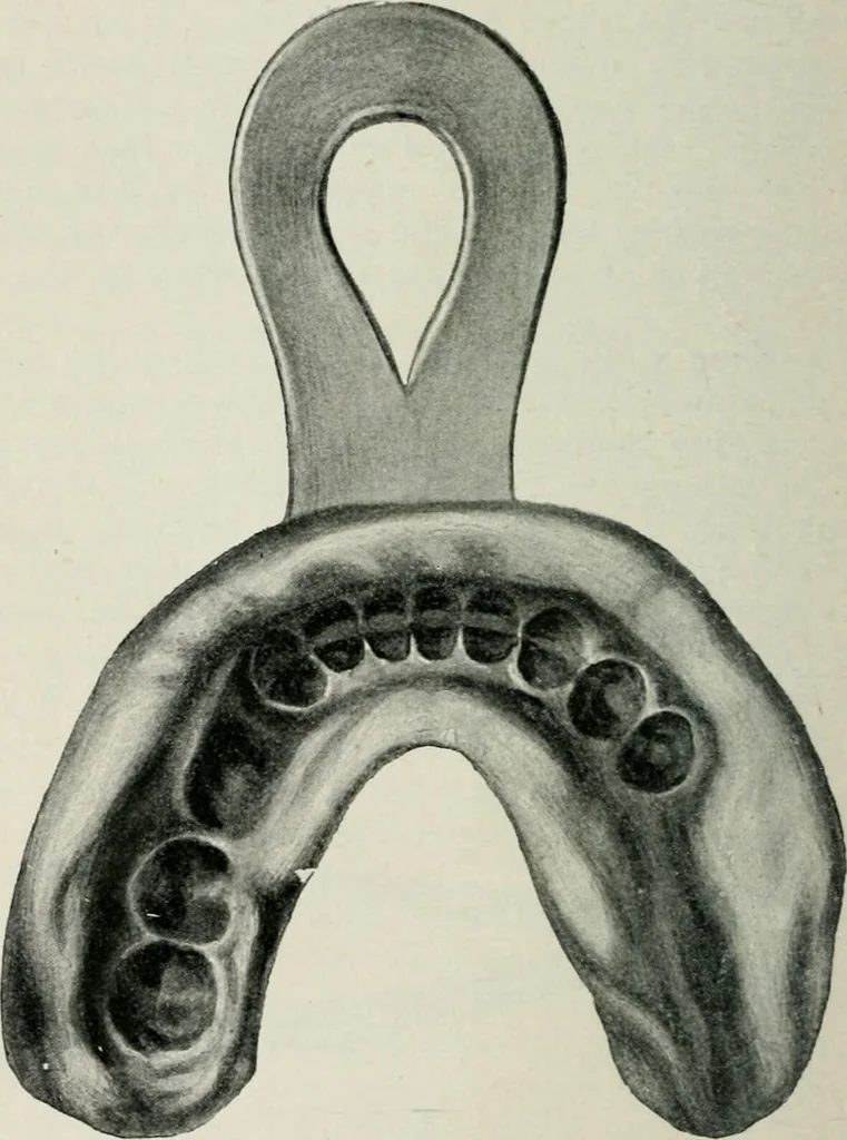 An illustration from Atlas and text-book of dentistry including diseases of the mouth / by Gustav Preiswerk. Edited by George W. Warren., 1906, leaf 442