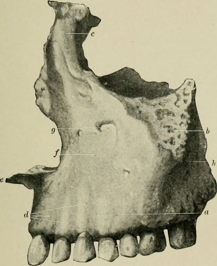 An illustration from Atlas and text-book of dentistry including diseases of the mouth / by Gustav Preiswerk. Edited by George W. Warren., 1906, leaf 47