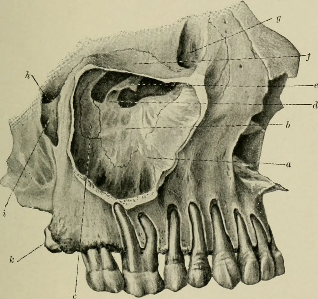 An illustration from Atlas and text-book of dentistry including diseases of the mouth / by Gustav Preiswerk. Edited by George W. Warren., 1906, leaf 53