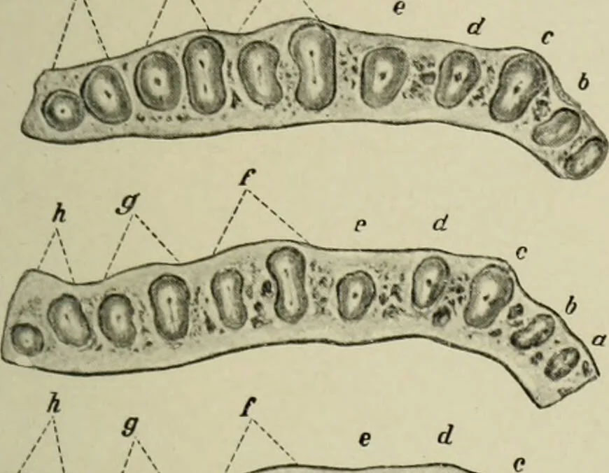 An illustration from Atlas and text-book of dentistry including diseases of the mouth / by Gustav Preiswerk. Edited by George W. Warren., 1906, leaf 63