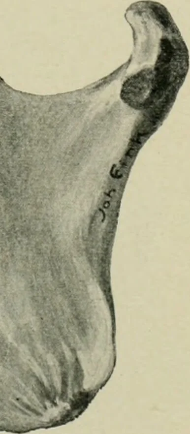 An illustration from Atlas and text-book of dentistry including diseases of the mouth / by Gustav Preiswerk. Edited by George W. Warren., 1906, leaf 65