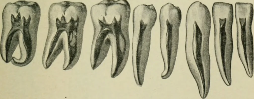 An illustration from Atlas and text-book of dentistry including diseases of the mouth / by Gustav Preiswerk. Edited by George W. Warren., 1906, leaf 71