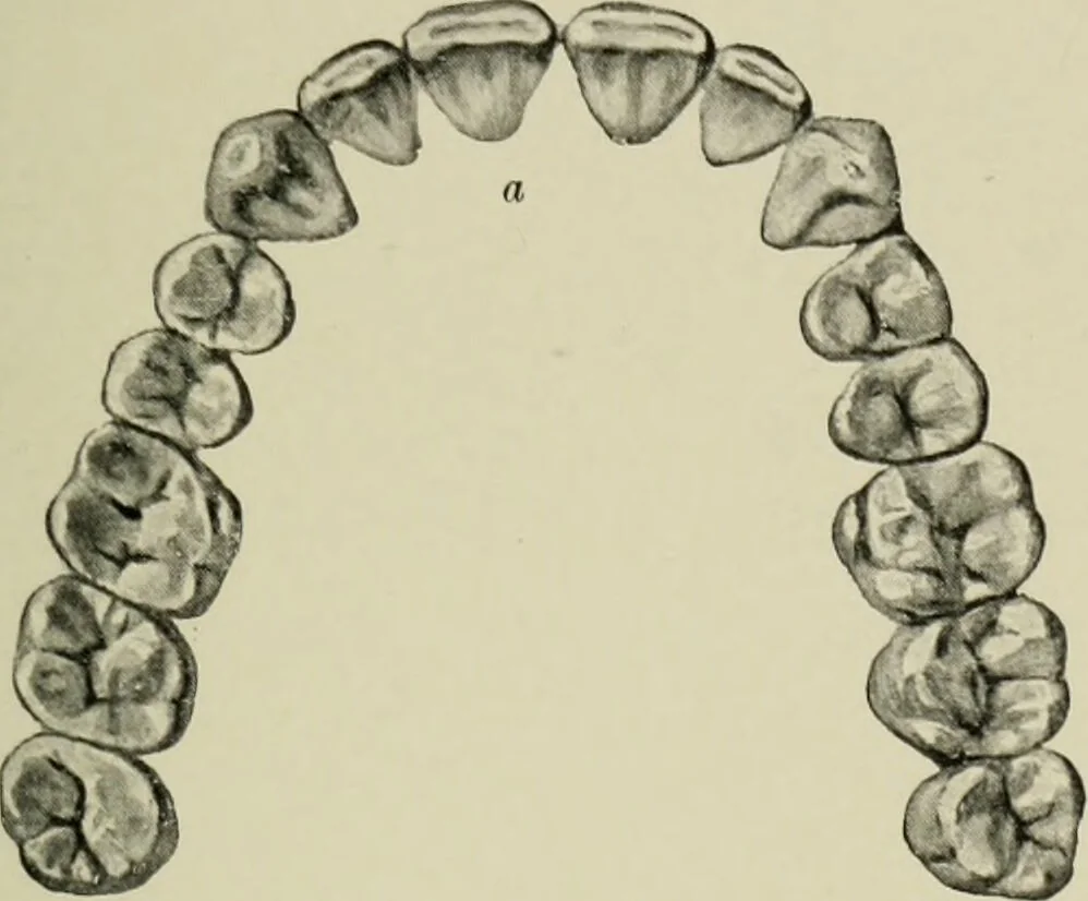 An illustration from Atlas and text-book of dentistry including diseases of the mouth / by Gustav Preiswerk. Edited by George W. Warren., 1906, leaf 85